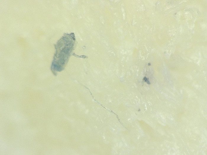 These Scientists Studied Chicken McNuggets Under A Microscope. You Will