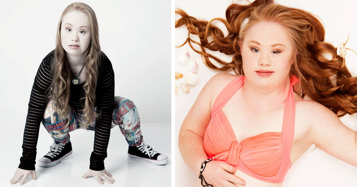 down-syndrome-model-maddy-fb